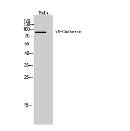 Western blot - VE-Cadherin Polyclonal Antibody from Signalway Antibody (41976) - Antibodies.com