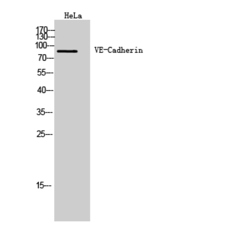 Western blot - VE-Cadherin Polyclonal Antibody from Signalway Antibody (41976) - Antibodies.com