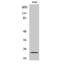 Western blot - Claudin-19 Polyclonal Antibody from Signalway Antibody (40748) - Antibodies.com