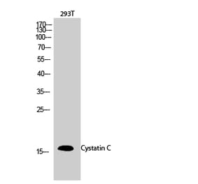 Western blot - Cystatin C Polyclonal Antibody from Signalway Antibody (40820) - Antibodies.com