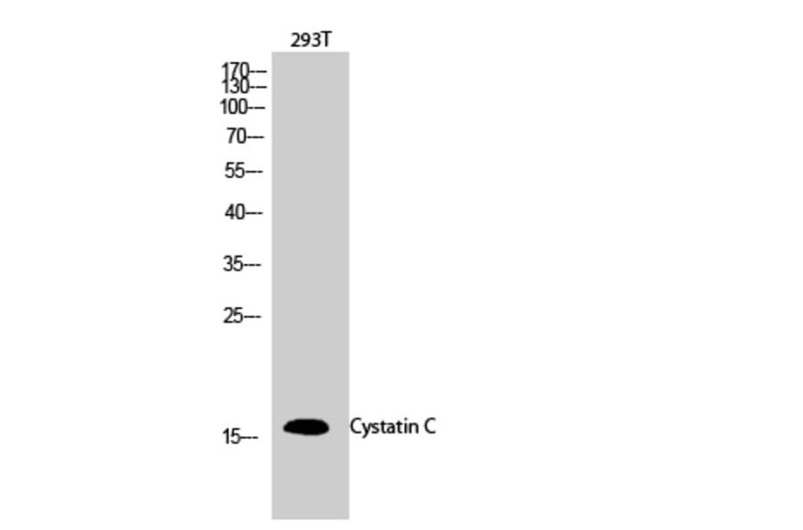 Western blot - Cystatin C Polyclonal Antibody from Signalway Antibody (40820) - Antibodies.com