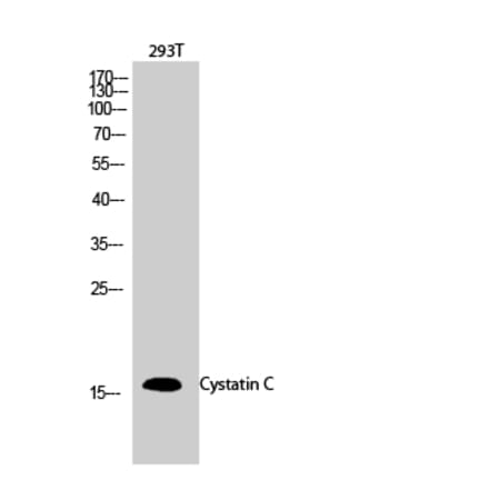 Western blot - Cystatin C Polyclonal Antibody from Signalway Antibody (40820) - Antibodies.com