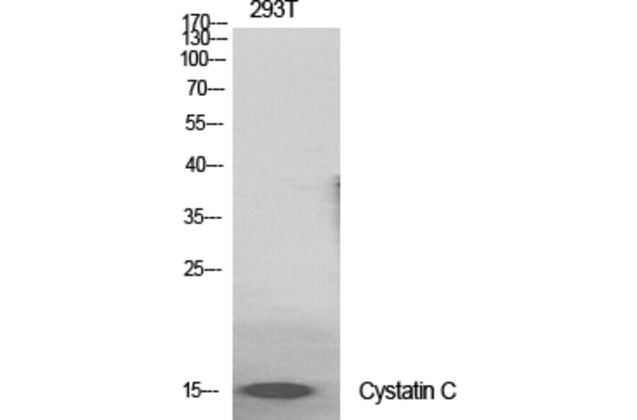 Western blot - Cystatin C Polyclonal Antibody from Signalway Antibody (40820) - Antibodies.com
