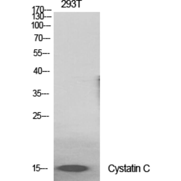 Western blot - Cystatin C Polyclonal Antibody from Signalway Antibody (40820) - Antibodies.com