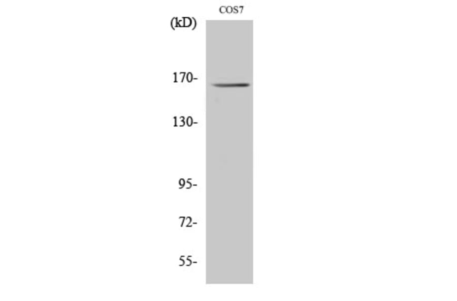 Western blot - Myomesin-2 Polyclonal Antibody from Signalway Antibody (41194) - Antibodies.com