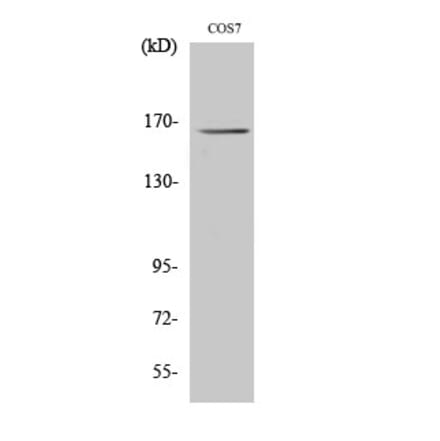 Western blot - Myomesin-2 Polyclonal Antibody from Signalway Antibody (41194) - Antibodies.com