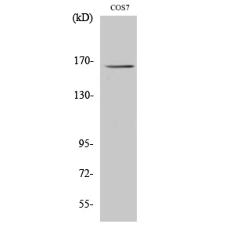 Western blot - Myomesin-2 Polyclonal Antibody from Signalway Antibody (41194) - Antibodies.com