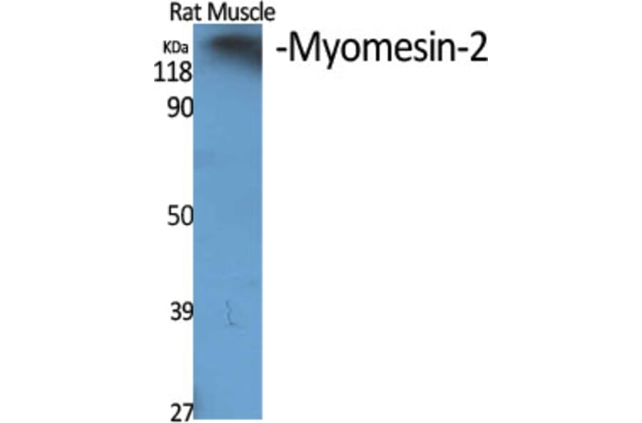 Western blot - Myomesin-2 Polyclonal Antibody from Signalway Antibody (41194) - Antibodies.com