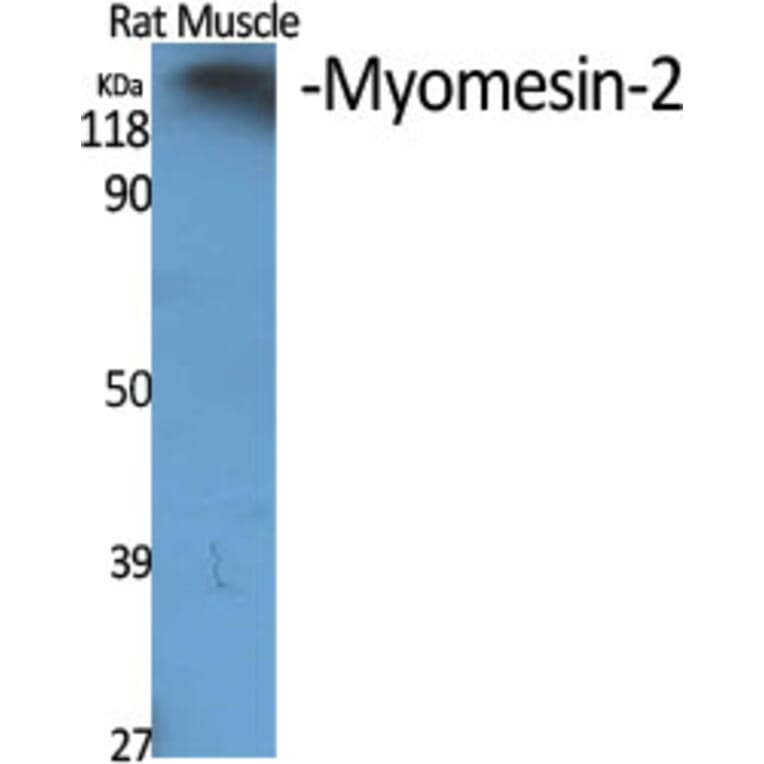 Western blot - Myomesin-2 Polyclonal Antibody from Signalway Antibody (41194) - Antibodies.com