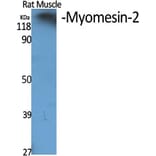 Western blot - Myomesin-2 Polyclonal Antibody from Signalway Antibody (41194) - Antibodies.com