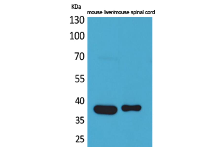 Western blot - Aldolase C Polyclonal Antibody from Signalway Antibody (41593) - Antibodies.com