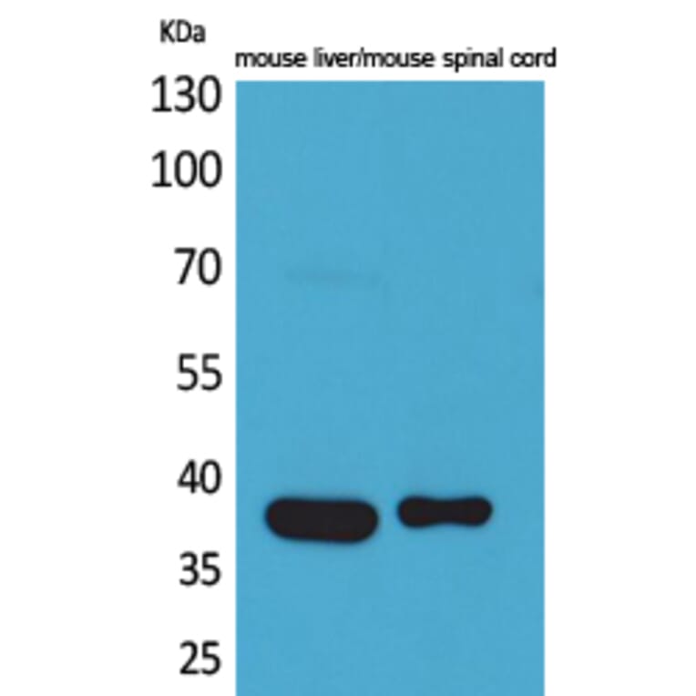 Western blot - Aldolase C Polyclonal Antibody from Signalway Antibody (41593) - Antibodies.com