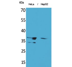 Western blot - Annexin II Polyclonal Antibody from Signalway Antibody (41612) - Antibodies.com