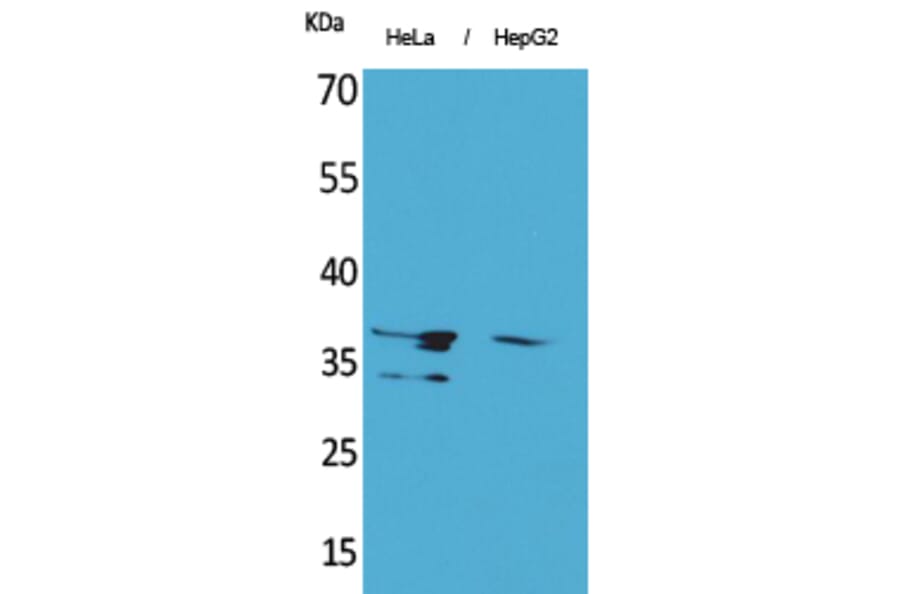 Western blot - Annexin II Polyclonal Antibody from Signalway Antibody (41612) - Antibodies.com