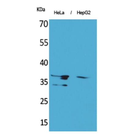 Western blot - Annexin II Polyclonal Antibody from Signalway Antibody (41612) - Antibodies.com