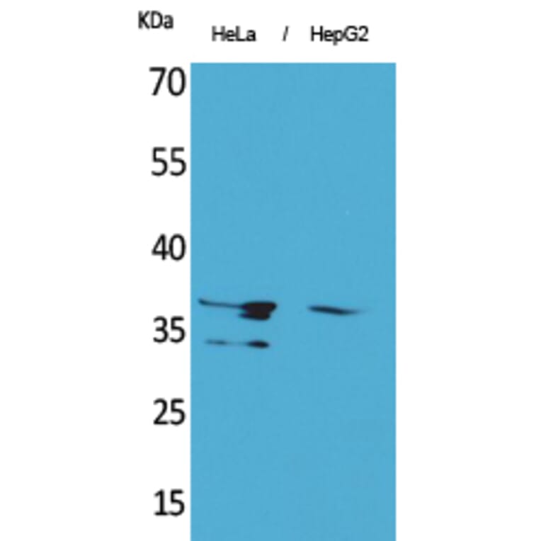 Western blot - Annexin II Polyclonal Antibody from Signalway Antibody (41612) - Antibodies.com