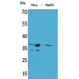 Western blot - Annexin II Polyclonal Antibody from Signalway Antibody (41612) - Antibodies.com