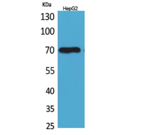 Western blot - Glypican-3 Polyclonal Antibody from Signalway Antibody (41615) - Antibodies.com