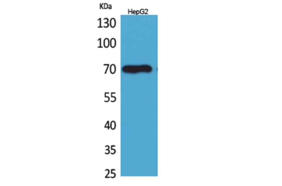 Western blot - Glypican-3 Polyclonal Antibody from Signalway Antibody (41615) - Antibodies.com