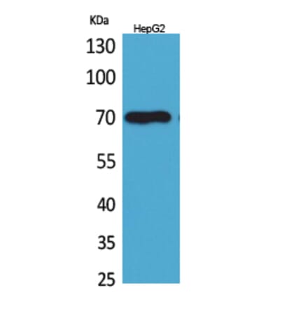 Western blot - Glypican-3 Polyclonal Antibody from Signalway Antibody (41615) - Antibodies.com