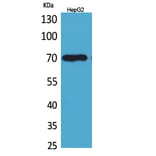 Western blot - Glypican-3 Polyclonal Antibody from Signalway Antibody (41615) - Antibodies.com