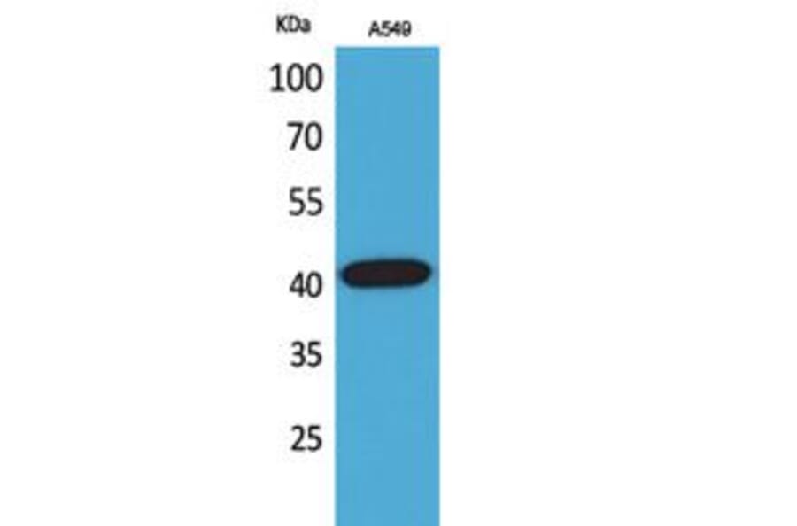 Western blot - L-Selectin Polyclonal Antibody from Signalway Antibody (41757) - Antibodies.com