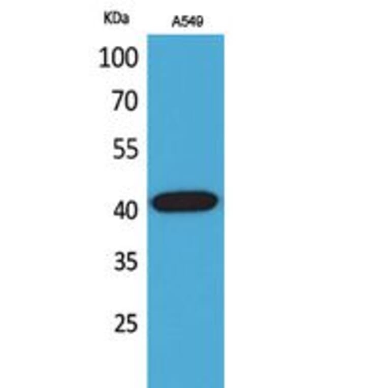 Western blot - L-Selectin Polyclonal Antibody from Signalway Antibody (41757) - Antibodies.com