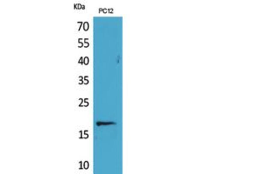 Western blot - Histone H3 Polyclonal Antibody from Signalway Antibody (41801) - Antibodies.com