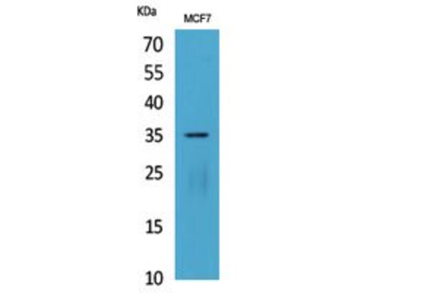 Western blot - IL-12A p35 Polyclonal Antibody from Signalway Antibody (41819) - Antibodies.com