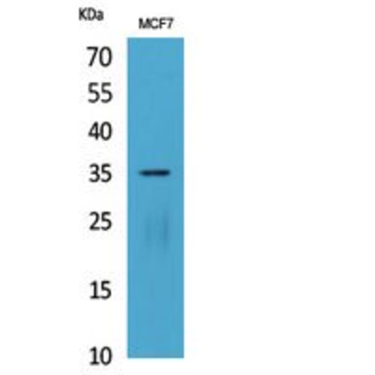 Western blot - IL-12A p35 Polyclonal Antibody from Signalway Antibody (41819) - Antibodies.com