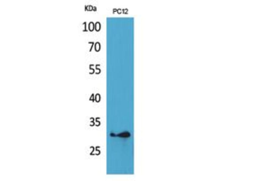 Western blot - HLA-DQB1/2 Polyclonal Antibody from Signalway Antibody (41863) - Antibodies.com