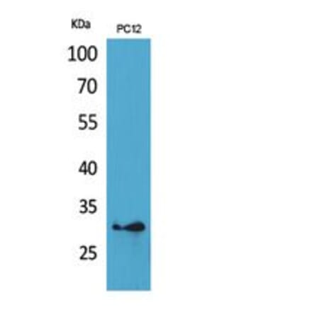 Western blot - HLA-DQB1/2 Polyclonal Antibody from Signalway Antibody (41863) - Antibodies.com