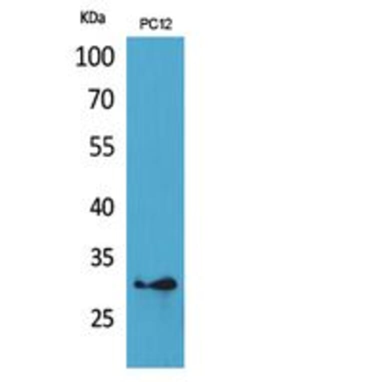 Western blot - HLA-DQB1/2 Polyclonal Antibody from Signalway Antibody (41863) - Antibodies.com