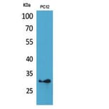 Western blot - HLA-DQB1/2 Polyclonal Antibody from Signalway Antibody (41863) - Antibodies.com