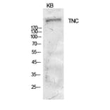 Western blot - Tenascin-C Polyclonal Antibody from Signalway Antibody (41914) - Antibodies.com