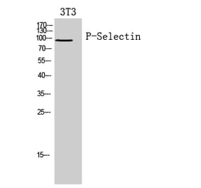 Western blot - P-Selectin Polyclonal Antibody from Signalway Antibody (41958) - Antibodies.com
