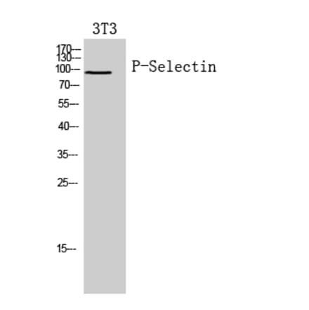 Western blot - P-Selectin Polyclonal Antibody from Signalway Antibody (41958) - Antibodies.com