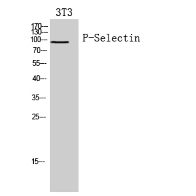 Western blot - P-Selectin Polyclonal Antibody from Signalway Antibody (41958) - Antibodies.com