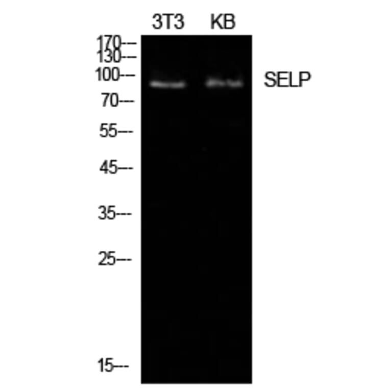 Western blot - P-Selectin Polyclonal Antibody from Signalway Antibody (41958) - Antibodies.com