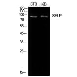 Western blot - P-Selectin Polyclonal Antibody from Signalway Antibody (41958) - Antibodies.com