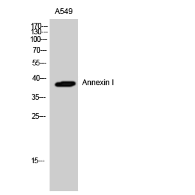 Western blot - Annexin I Polyclonal Antibody from Signalway Antibody (40591) - Antibodies.com