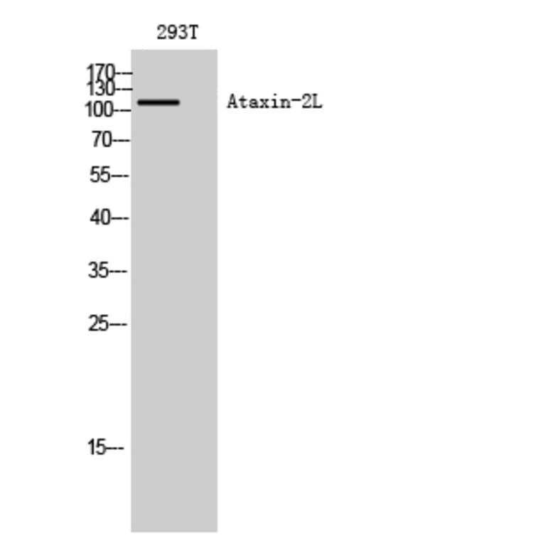 Western blot - Ataxin-2L Polyclonal Antibody from Signalway Antibody (40623) - Antibodies.com