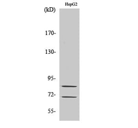 Western blot - Choactase Polyclonal Antibody from Signalway Antibody (40743) - Antibodies.com