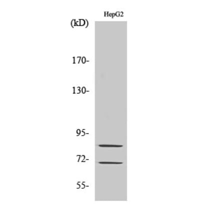 Western blot - Choactase Polyclonal Antibody from Signalway Antibody (40743) - Antibodies.com