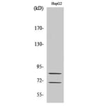 Western blot - Choactase Polyclonal Antibody from Signalway Antibody (40743) - Antibodies.com
