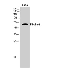 Western blot - Fibulin-5 Polyclonal Antibody from Signalway Antibody (40926) - Antibodies.com