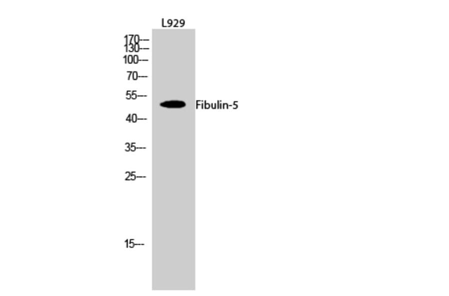 Western blot - Fibulin-5 Polyclonal Antibody from Signalway Antibody (40926) - Antibodies.com