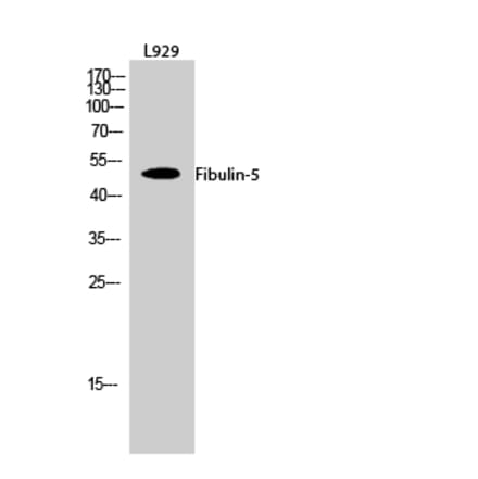 Western blot - Fibulin-5 Polyclonal Antibody from Signalway Antibody (40926) - Antibodies.com