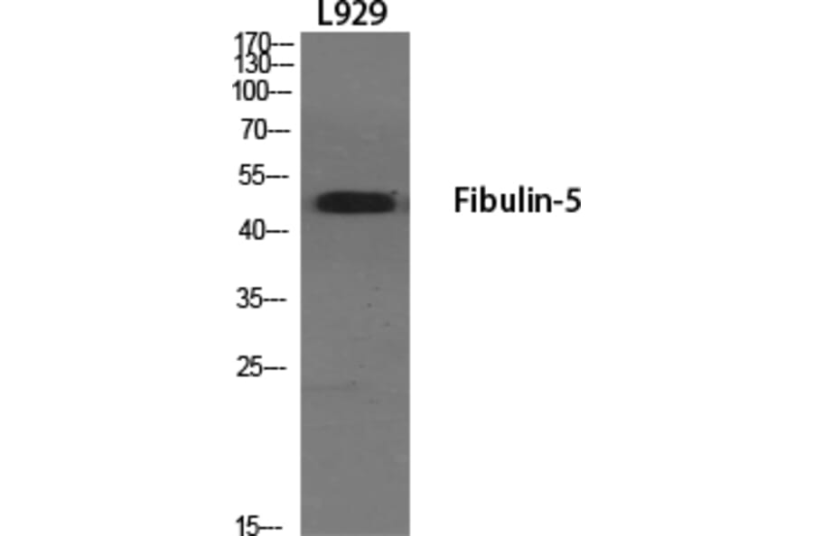 Western blot - Fibulin-5 Polyclonal Antibody from Signalway Antibody (40926) - Antibodies.com