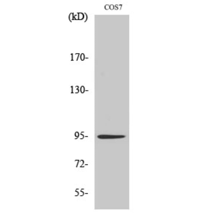 Western blot - Insulin R Polyclonal Antibody from Signalway Antibody (41066) - Antibodies.com